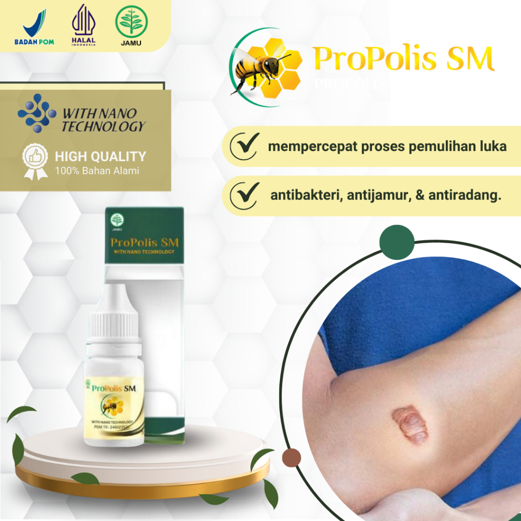 Propolis SM - Obat Keloid Bekas Luka Daging Tumbuh Bekas Luka Sesar Luka Tindik Injeksi Keloid Menah