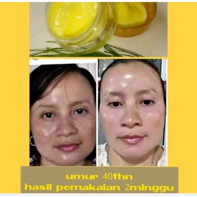 salep penghilang flek hitam tebal dan bandel