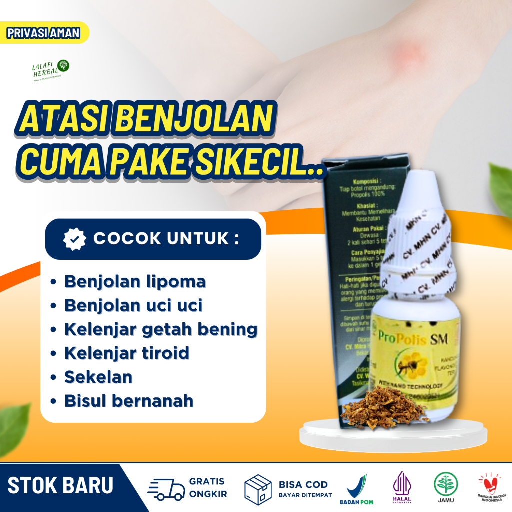 Obat Benjolan Lipoma Penghancur Benjolan Ditangan Penghilang Uci Uci Sekelan Minum Oles Propolis SM