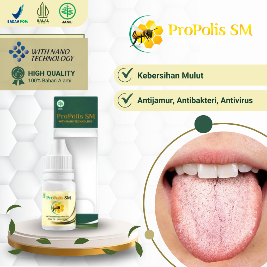 Obat Lidah Putih, Obat Lidah Berjamur, Obat Kandidiasis Oral, Obat Kandidiasis Mukokutan, Obat Infek