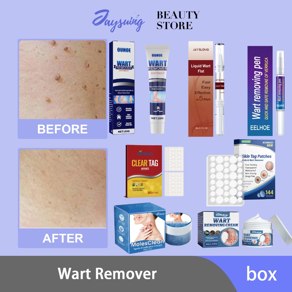 Wart Remover Cream Original ﻿﻿simofun wart removal skin tag