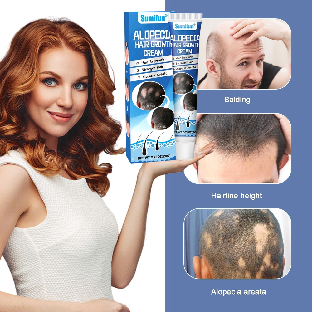 Obat rambut botak / serum penumbuh rambut botak / penumbuh rambut botak / obat penumbuh rambut botak