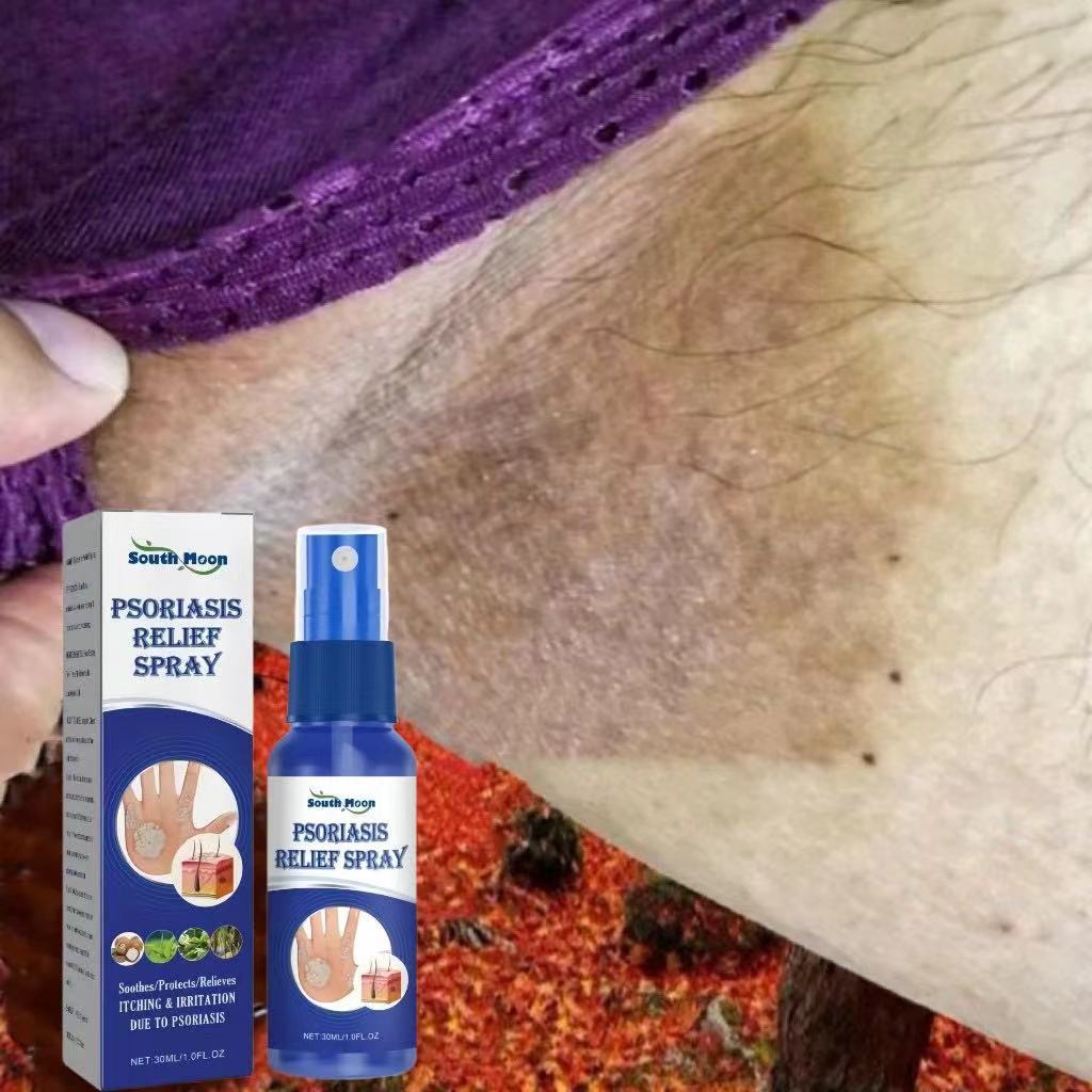 【100% Ori】Salep gatal paling ampuh obat gatal selangkangan obat gatal paling ampuh 30ml Salep gatal 