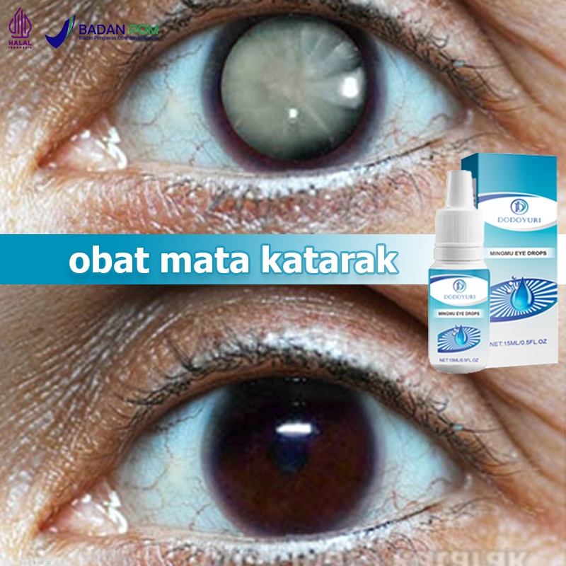 Obat mata katarak Obat mata minus Obat tetes mata Tetes mata 15ml Obat mata Obat katarak Obat tetes 