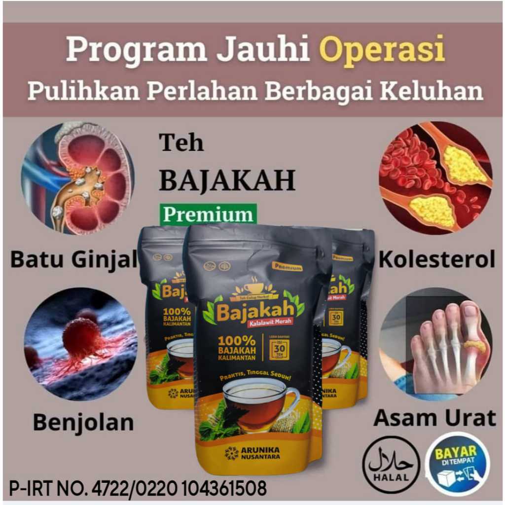 

Bajakah Teh Seduh Atasi Batu Ginjal Asam Urat