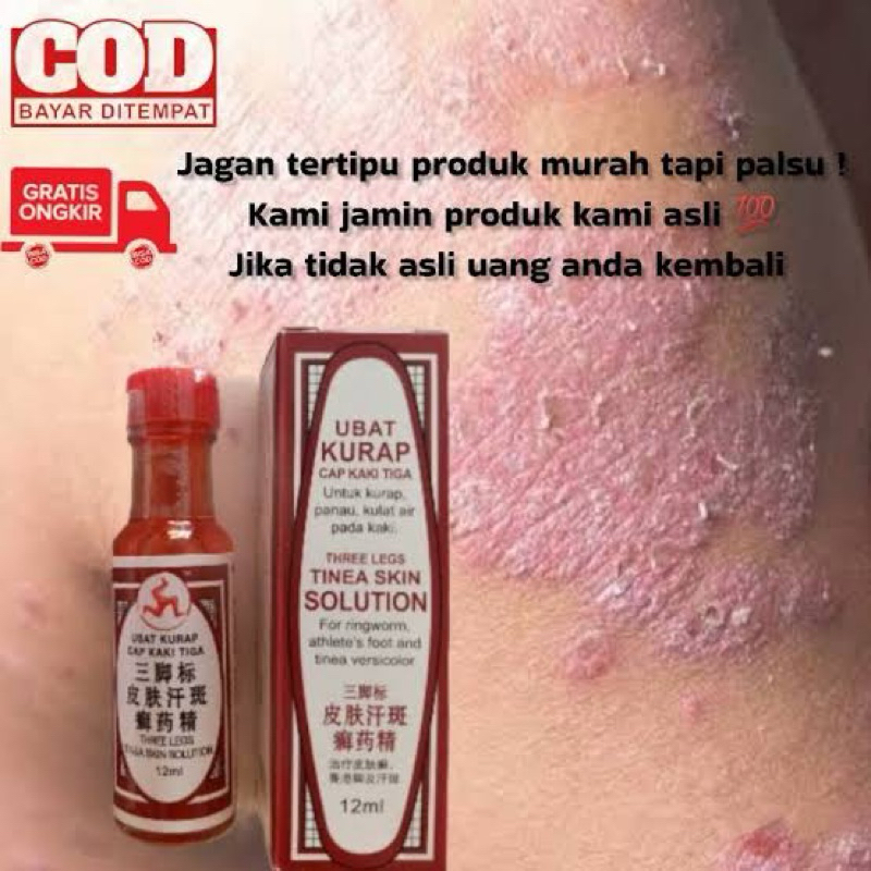 Obat kurap cap kaki tiga cair 12ml merah Original