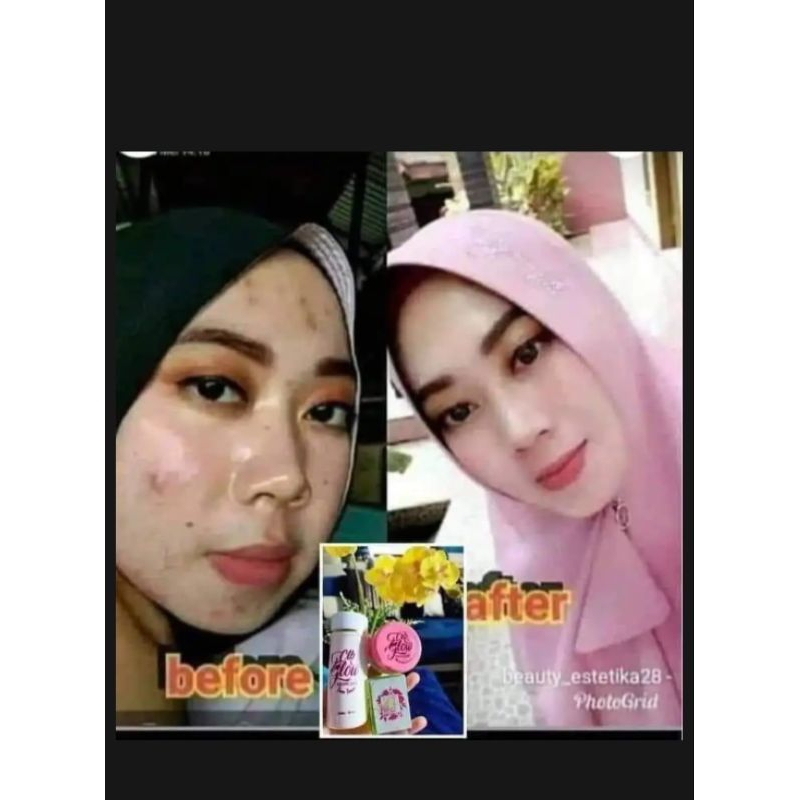 PAKET HEMAT CLB GLOW SKINCARE (2 CREAM)