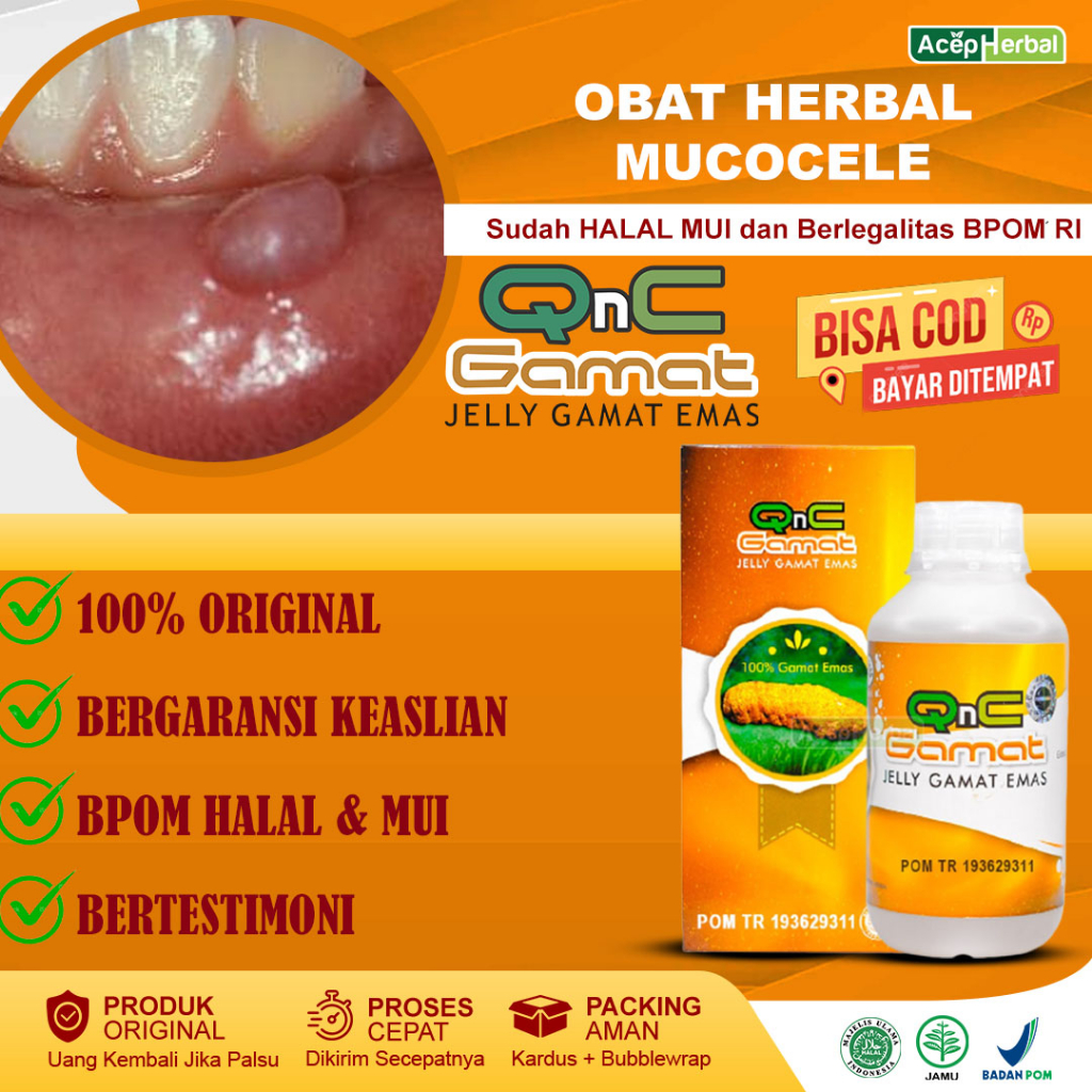 Obat Benjolan Obat Benjolan Di Mulut Lidah Gusi Obat Benjolan Di Bibir Obat Benjolan di Bawah Lidah 