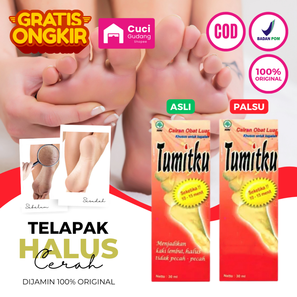 Obat Kaki Pecah Pecah - Tumitku Obat Kaki Pecah Original Krim Kaki Pecah Dan Kering Pelembab Kaki Pe