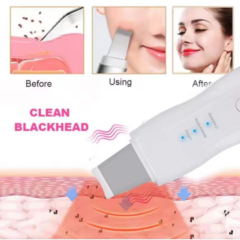 Skin Scrubber Ultrasonik Alat Multifungsi Rejuvination Pengilang Komedo