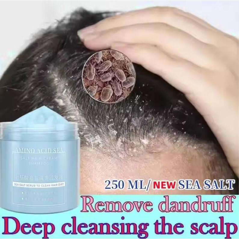 Sampo anti ketombe dan gatal 250ml Pengobatan folikulitis dan psoriasis Pembersihan lembut dan pengo