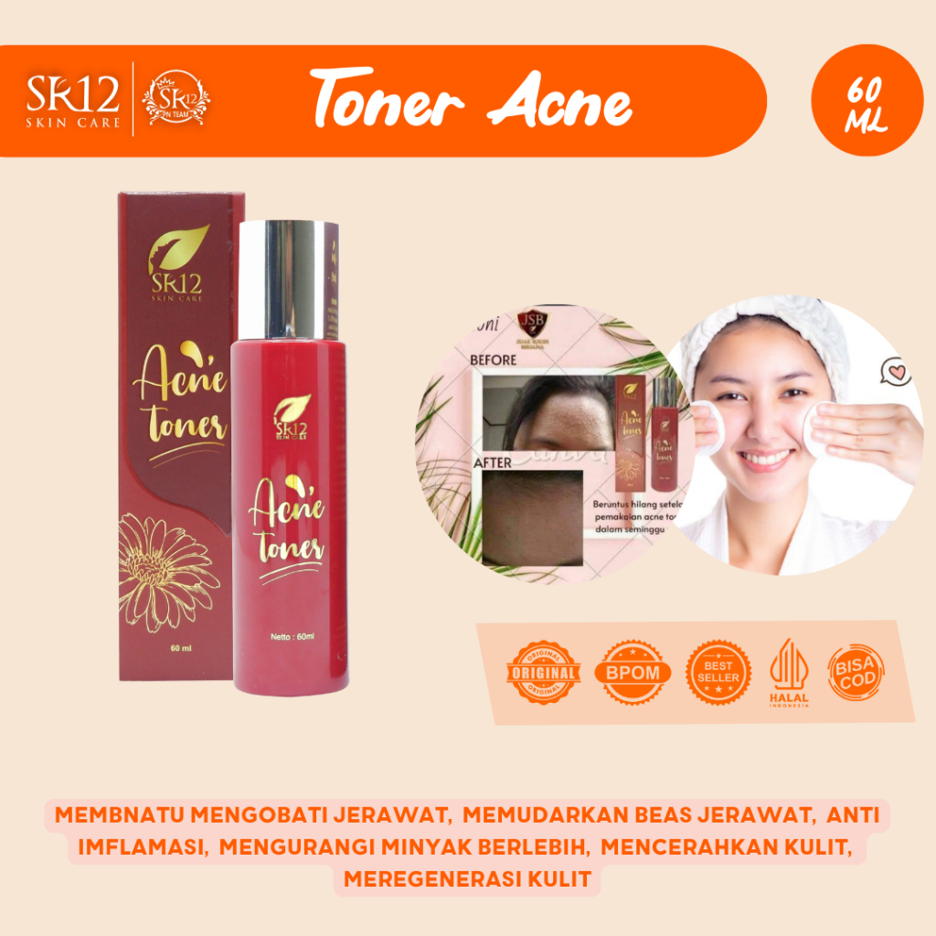 ACNE TONER SR12 BPOM / MEMBANTU MENGURANGI JERAWAT DIWAJAH