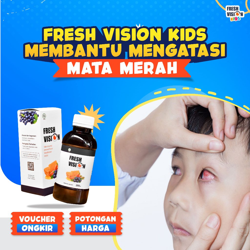 

FRESH VISION KIDS – Madu Vitamin Anak Untuk Membantu Mengatasi Mata Merah