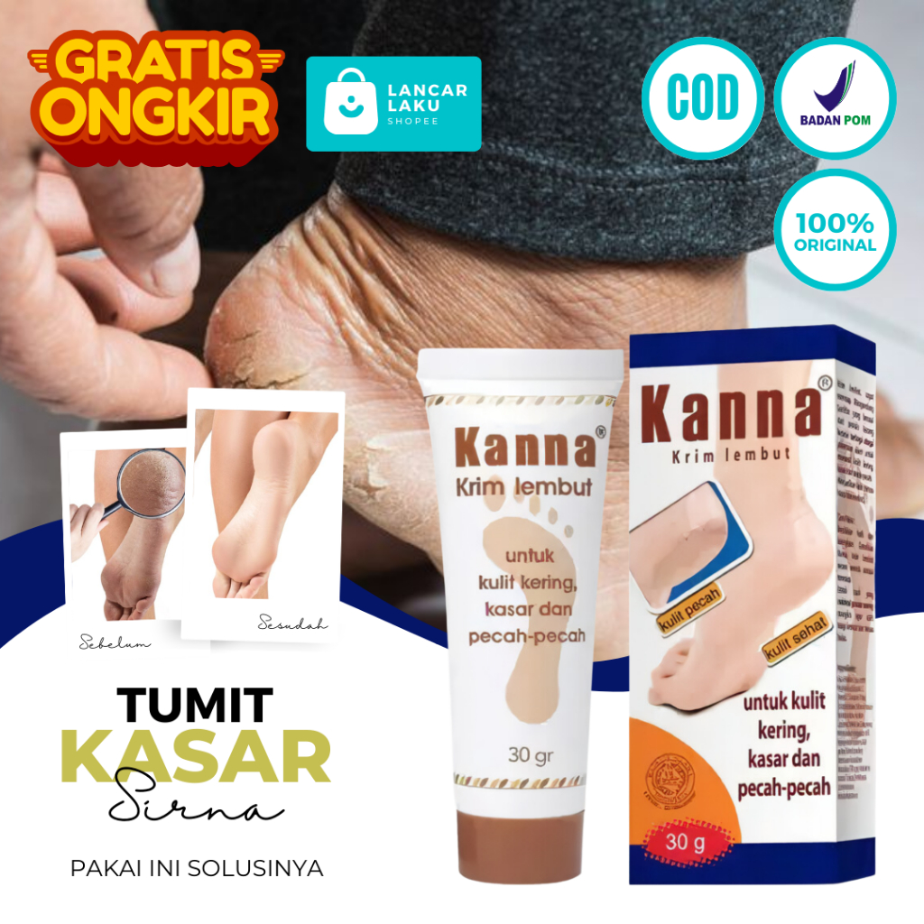 [ORIGINAL] Kanna Cream Kaki - Obat Krim Kaki Pecah Pecah Dan Kering Salep Pembersih Tumit Pecah Kasa