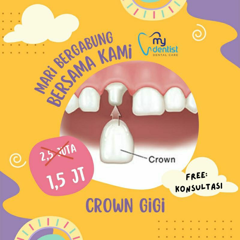 Voucher Crown Gigi / Pemasangan Mahkota Gigi Permanen