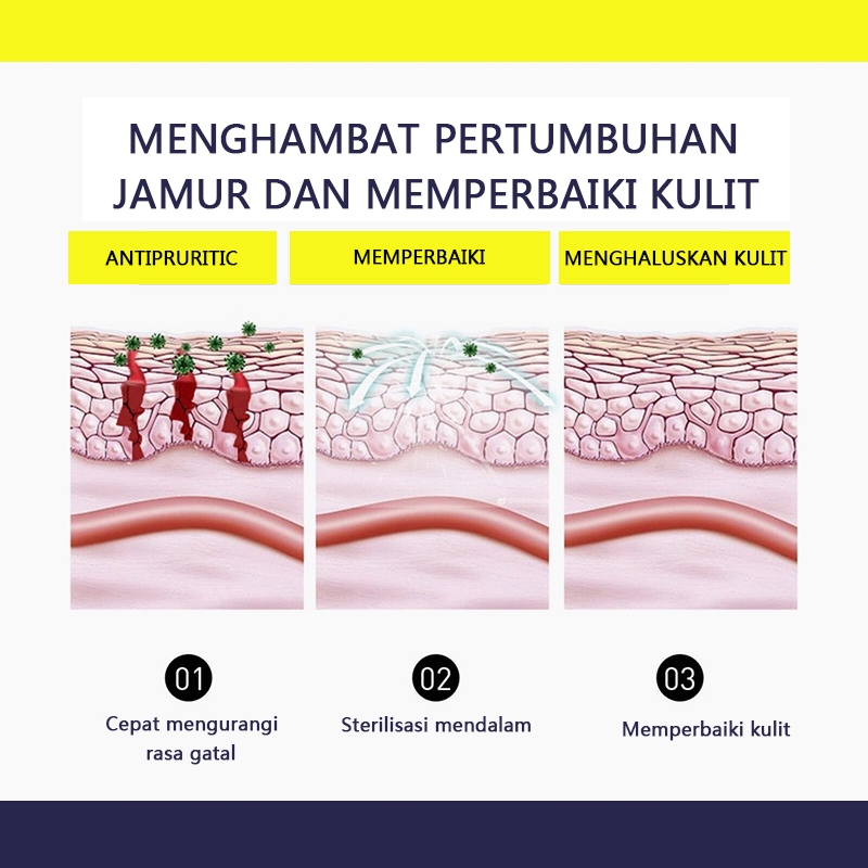 Salep jamur kulit salep eksim salep gatal paling ampuh salep gatal 30g Kulit Kepala Psoriasis Tangan Tinea Kaki Bau Versicolor Menghambat Dermatitis Jamur Anti Gatal Cream Menghambat Dermatitis Jamur Anti Gatal Cream