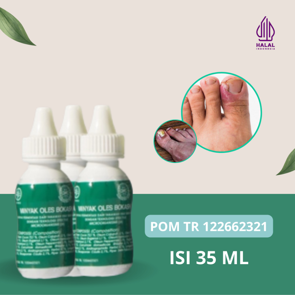 Obat Tetes Cantengan Bernanah Bau Jempol Kaki Cantengan Luka Di Jempol Kaki