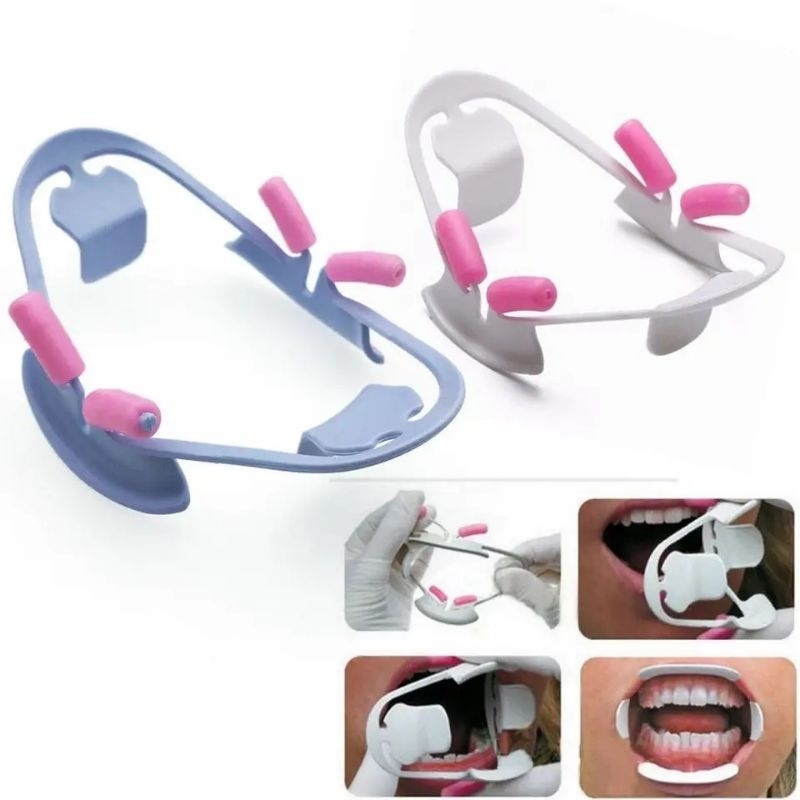 Cheek retractor bleaching/Auto Cheek Retractor Mouth Opener Pembuka Mulut