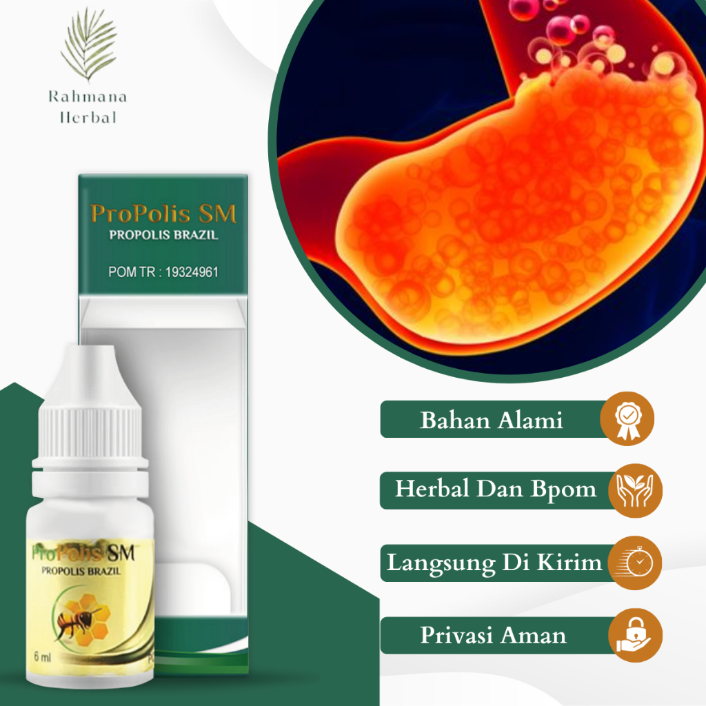 Obat Sakit Lambung, Obat Asam Lambung Naik, Obat Lambung Kronis, Obat Tukak Lambung, Obat Luka Lambu