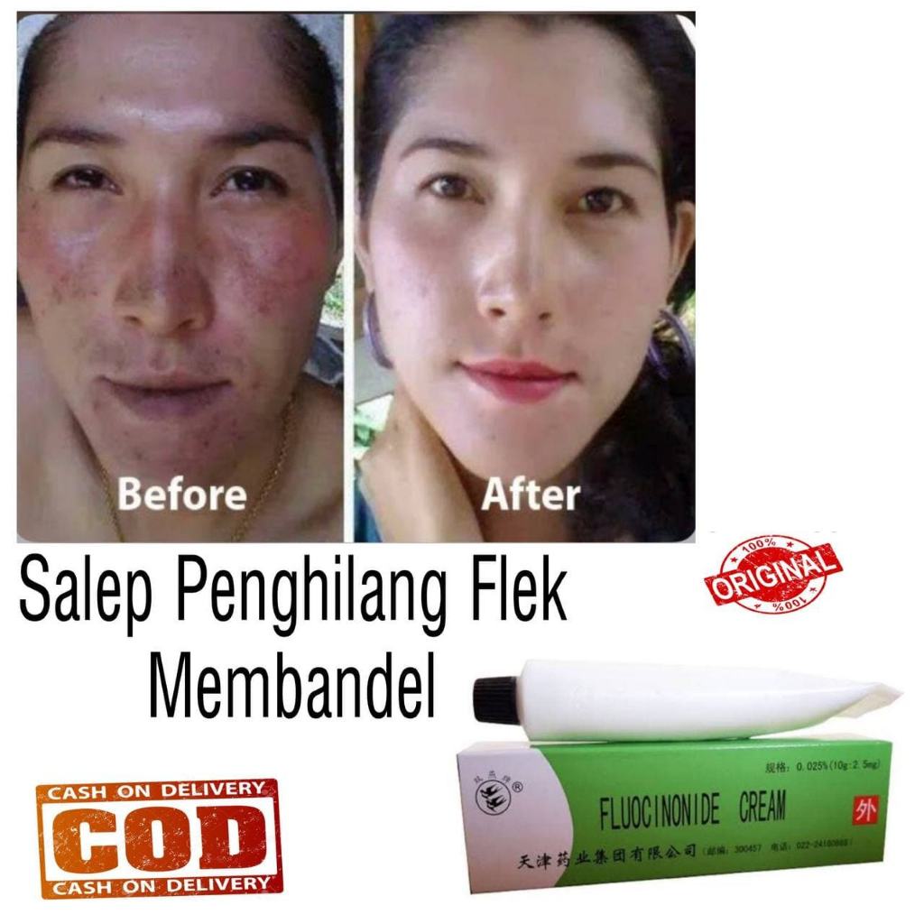 2 Salep Walet Lightening Cream Original - SOLUSI FLEK HITAM - JERAWAT DAN NODA PADA WAJAH