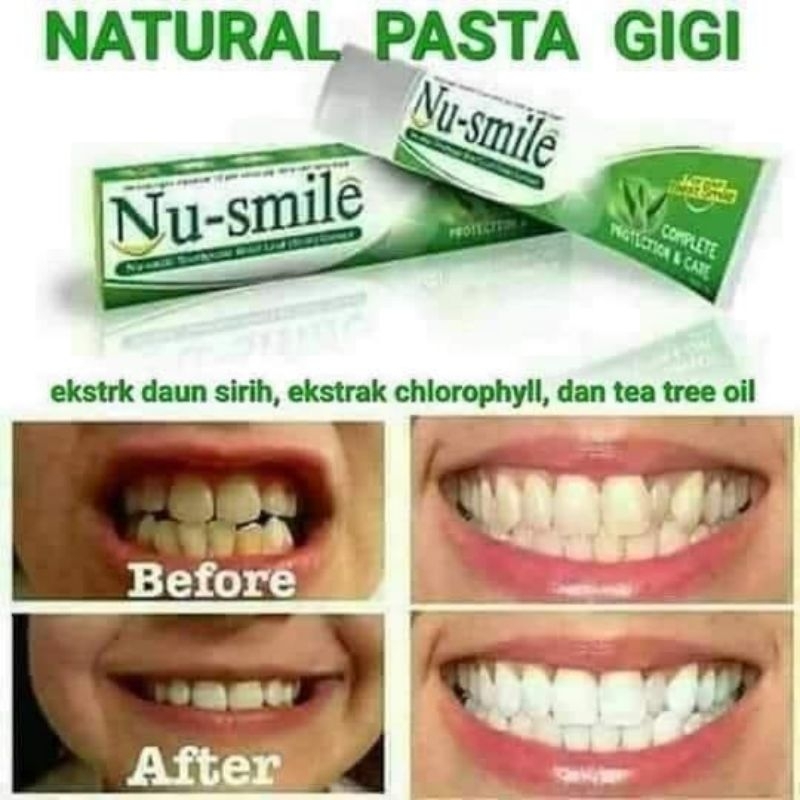 Nu smile