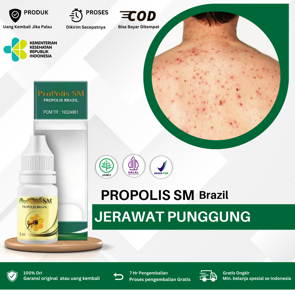 Obat Jerawat punggung, Penghilang Jerawat Punggung, Salep Jerawat punggung, Obat jerawat badan, Obat