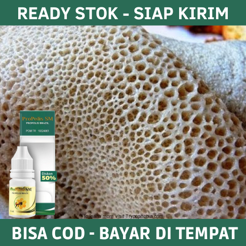 Obat Kaki Rayapan, Obat Kaki Rayapan dan Bau, Obat Kaki Bolong-Bolong, Obat Kaki Rayapan Telapak Kak