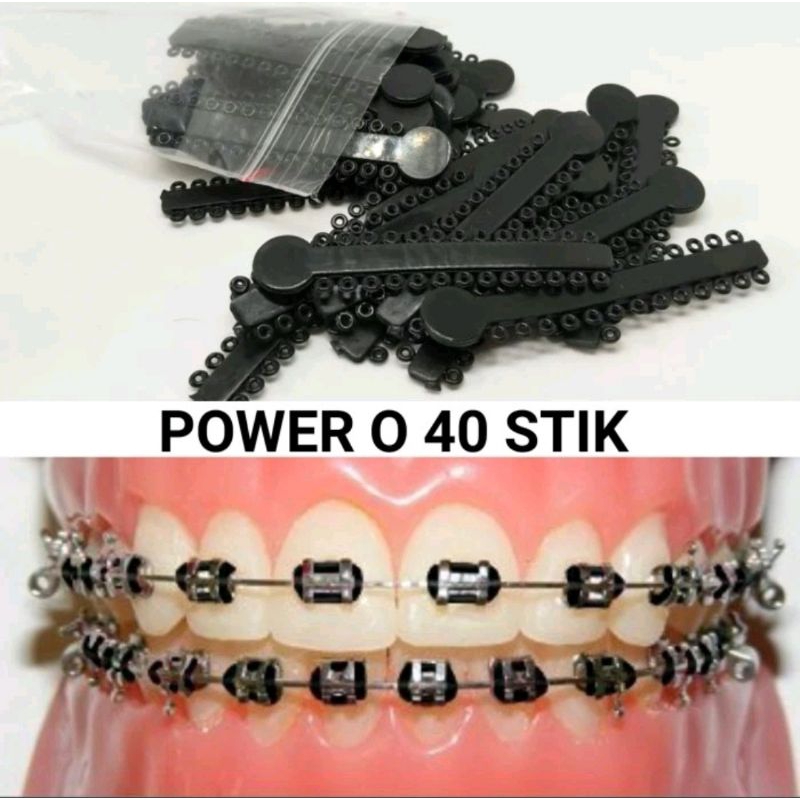 Karet behel power O isi 40pcs