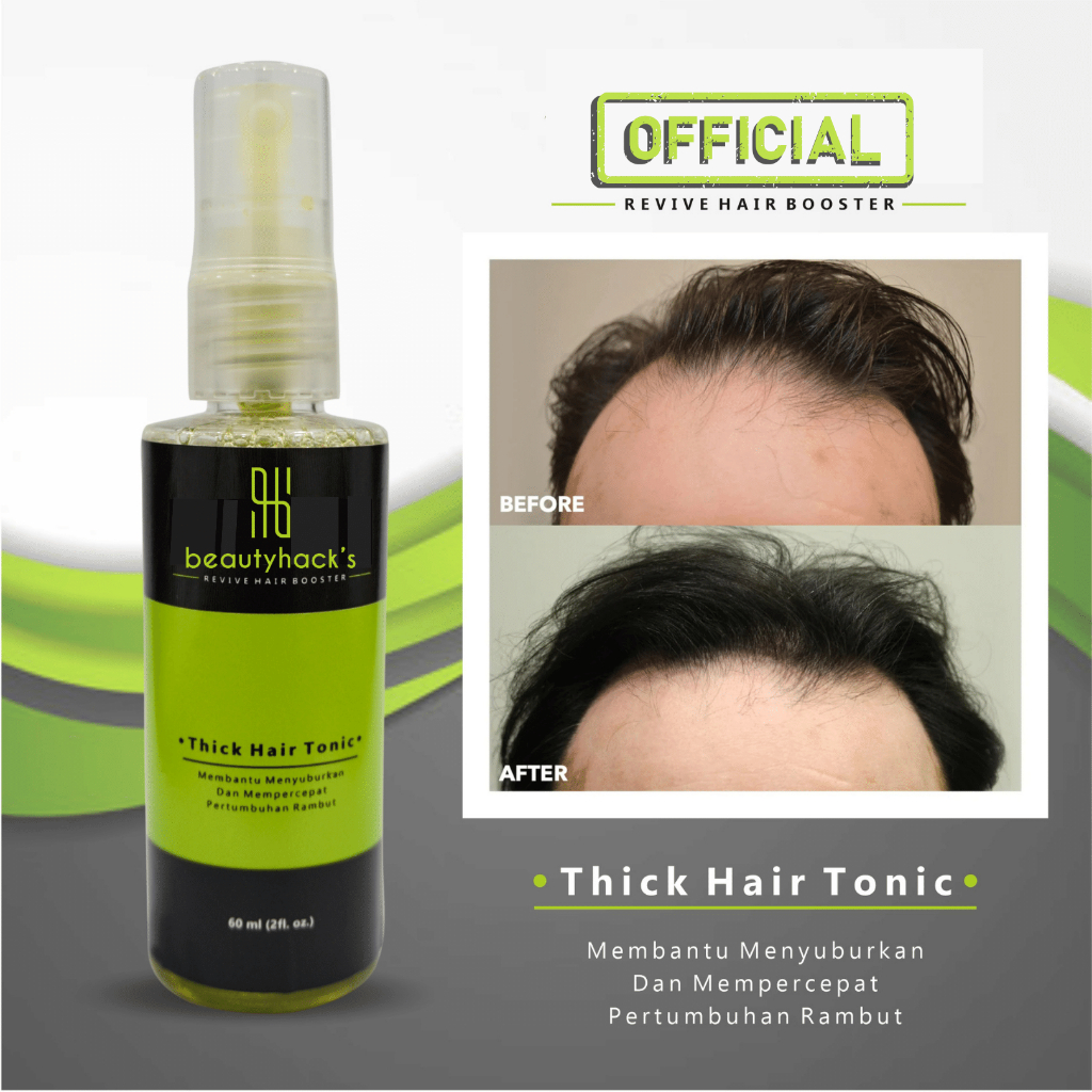Hazel Hair Tonic Penumbuh Rambut Kebotakan Terbaik Resmi BPOM