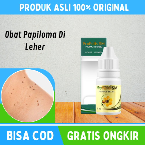 Obat Papiloma Herbal, Obat Penghilang Papiloma, Obat Kutil, Obat Kutil Di Leher, Obat Kutil Tangan, 