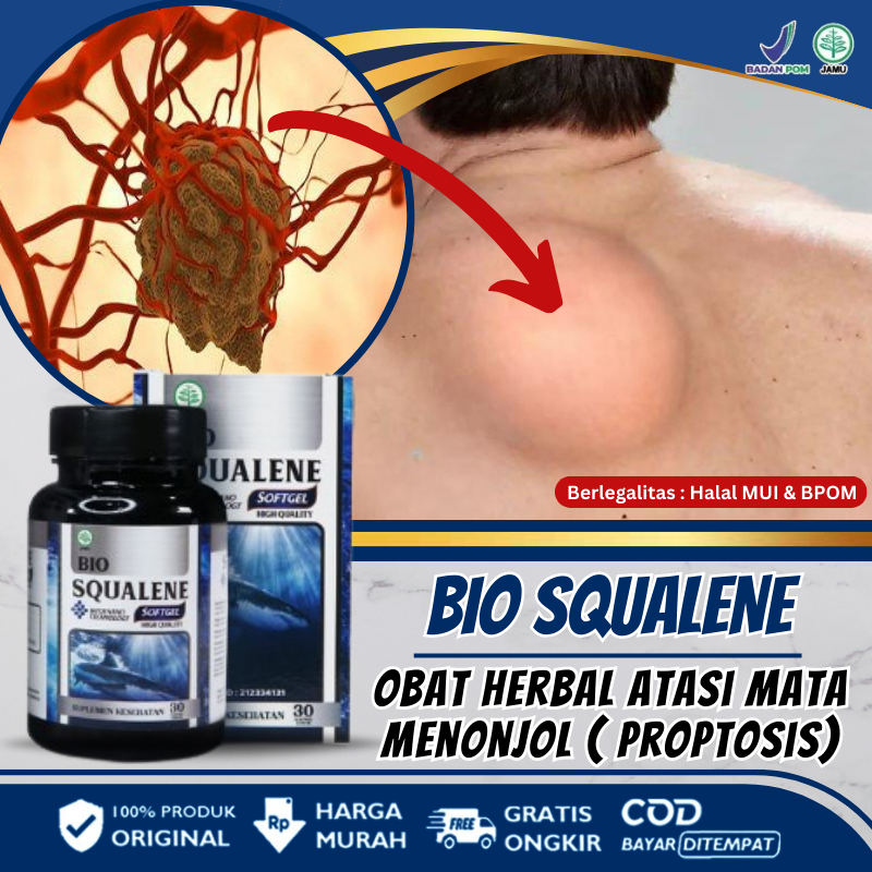 Obat Benjolan Lipoma di Punggung, Pengobatan Penyakit Benjolan di Tubuh Secara Alami Berizin BPOM, O