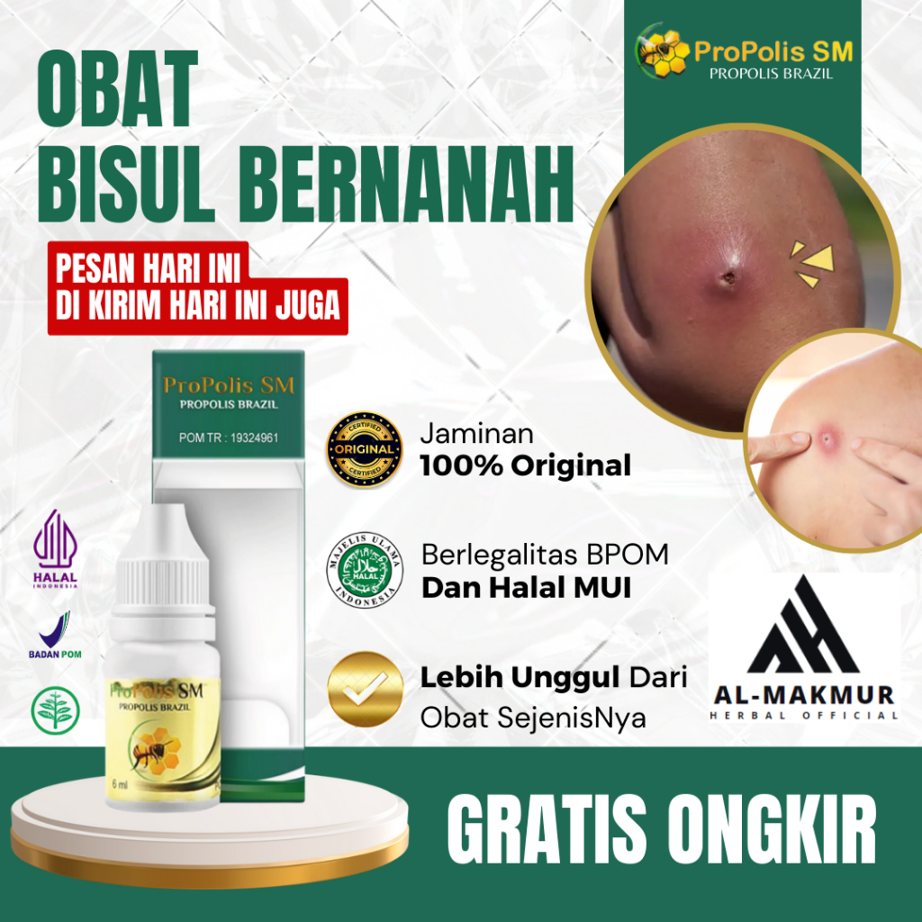 Obat Bisul, Obat Bisul Bernanah, Obat Penghilang Bengkak, Obat Pembasmi Bisul, Obat Bisul DiPantat, 