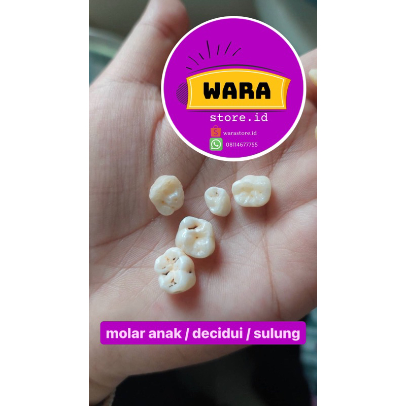 Gigi molar 1 2 anak decidui sulung susu rahang atas bawah kanan kiri (unsur 54 55 64 65 74 75 84 85)