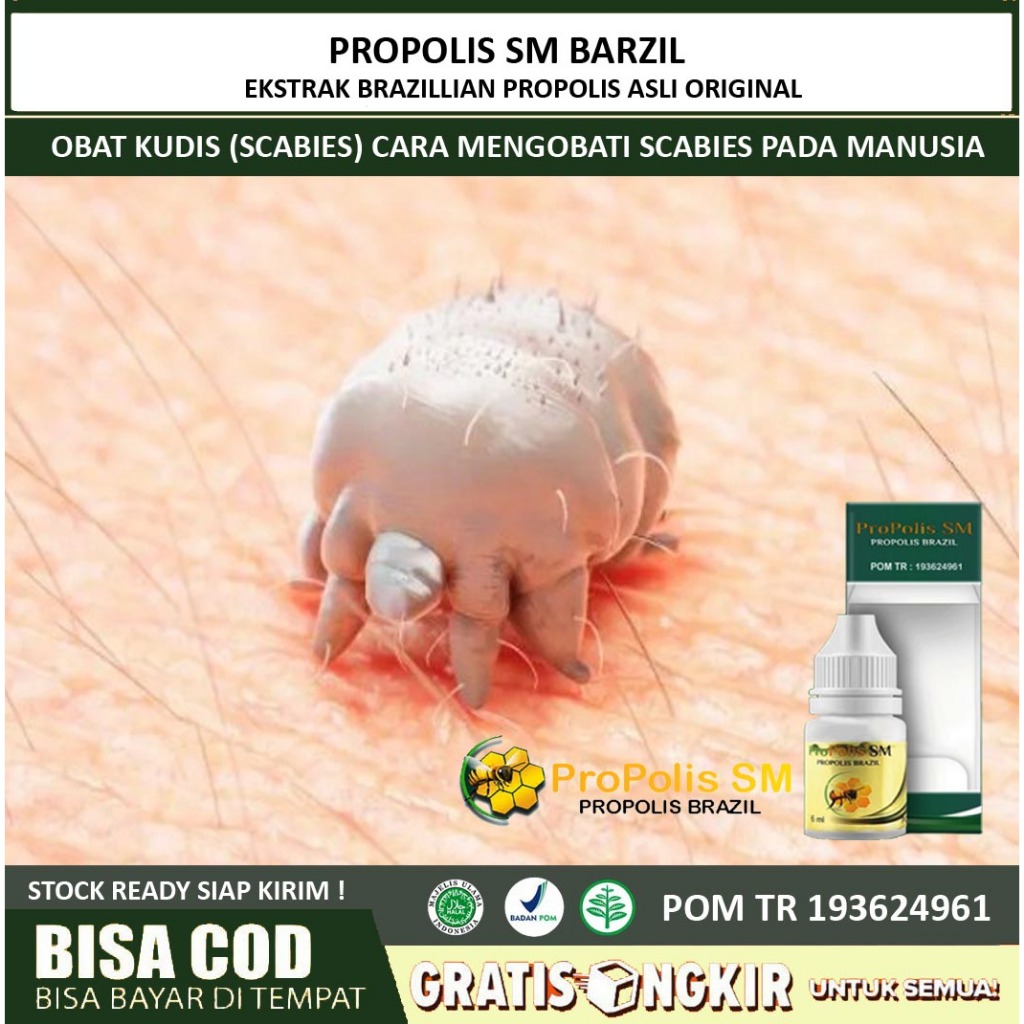 Obat Kudis (Scabies) Cara Mengobati Scabies Pada Manusia Obat Scabies di Apotik