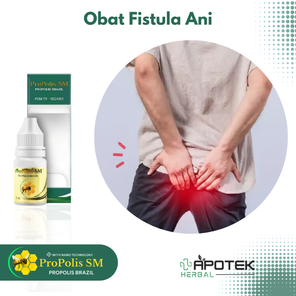 Obat Fistula Ani Benjolan di Anus Abses Anus Bengkak Ambeien Wasir Bab Berdarah Bisul di Pantat Abse