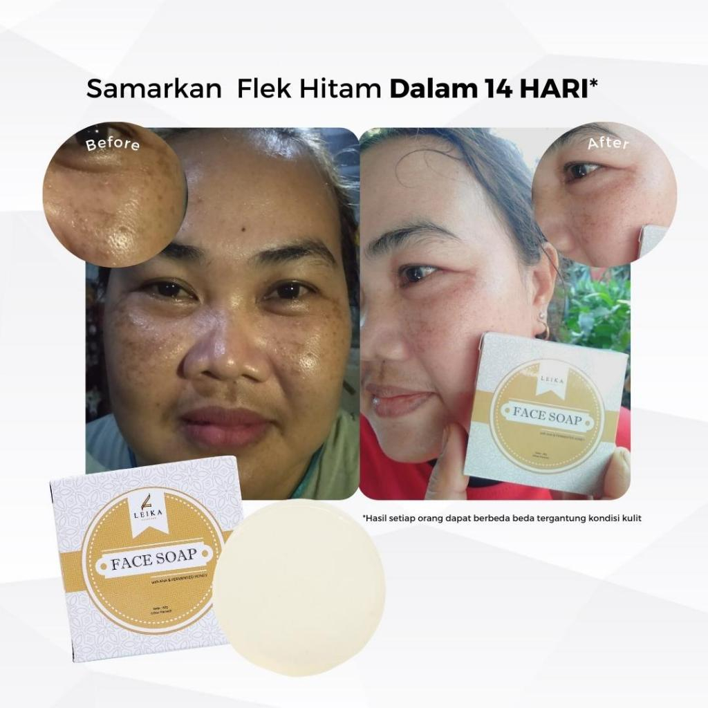 RAHASIA SUAMI BETAH DI RUMAH  Angkat FLEK HITAM sampai ke AKAR-AKARNYA Sabun khusus flek hitam di wa