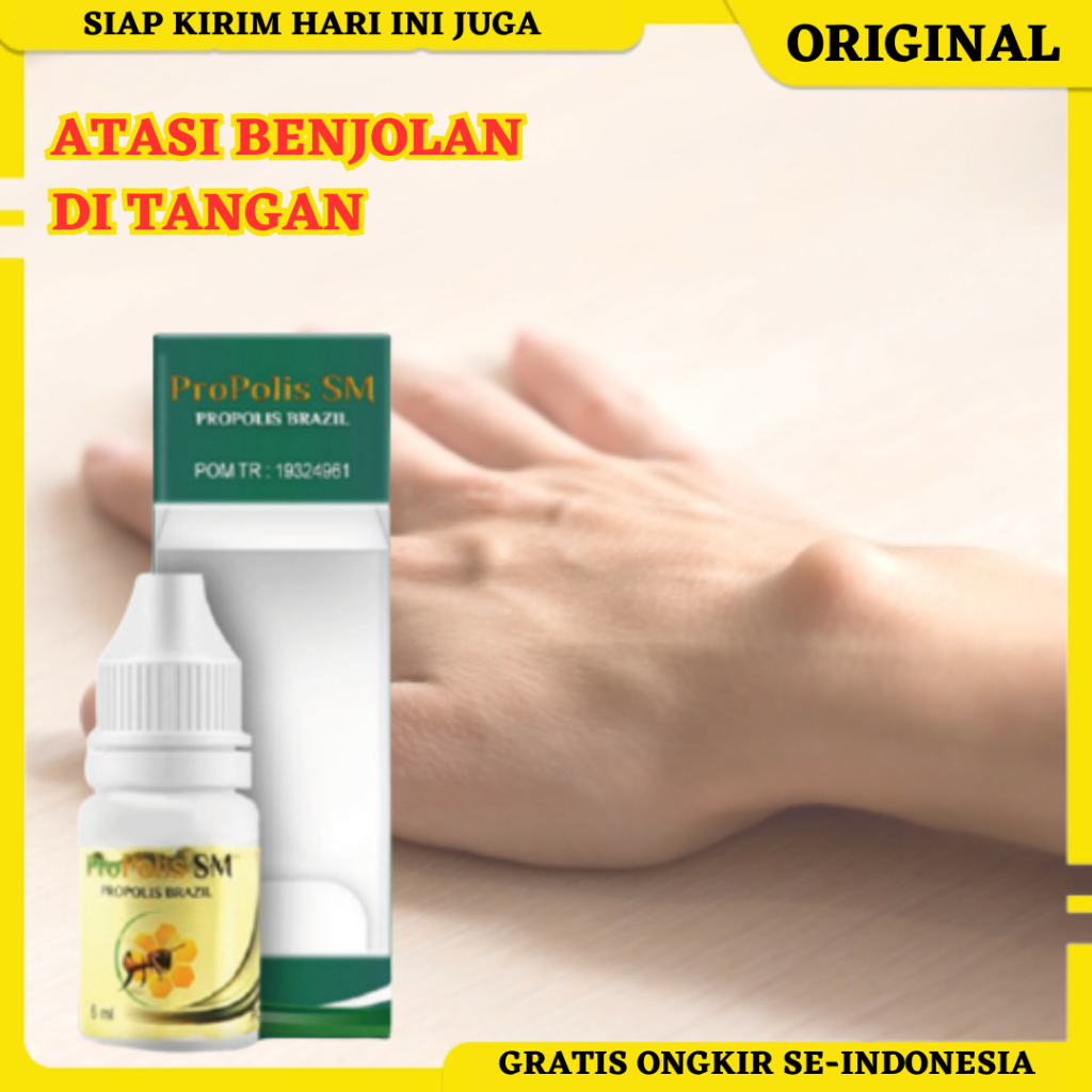 Propolis SM, Obat Benjolan di Tangan, Obat Benjolan di Pergelangan Tangan, Obat Benjolan Telapak Tan