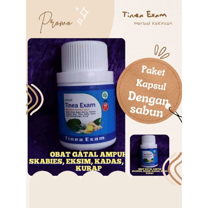 Tinea Exam Kapsul Saja Tanpa Salep + Sabun