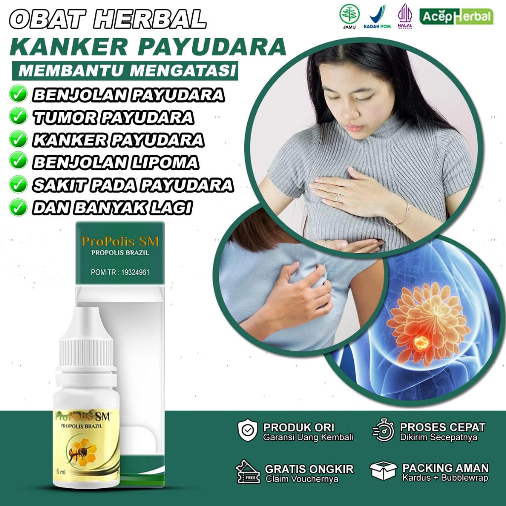 Obat Benjolan Payudara, Obat Bengkak Payudara, Obat Tumor Payudara,  Obat Infeksi Payudara, Obat Gat