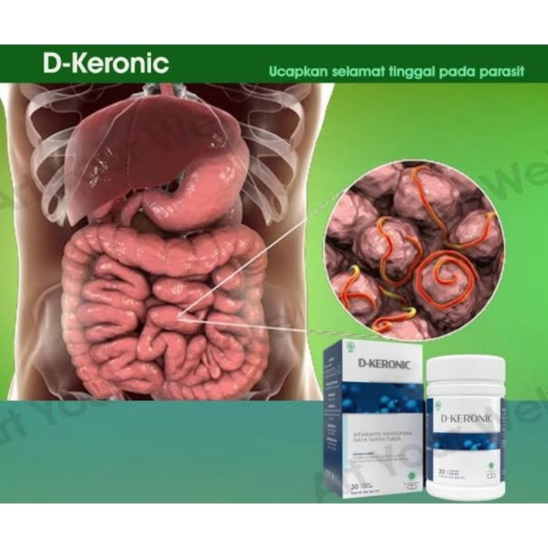D-Keronic Asli Obat Herbal Atasi Parasit Dan Bau Mulut Hilangkan Cacing Papiloma
