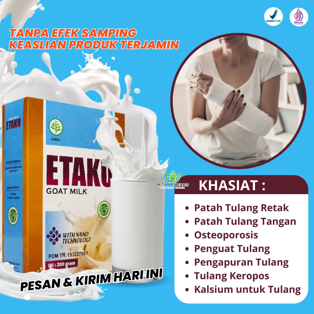 Susu Patah Tulang Dan Retak, Susu Patah Tulang Tangan, Susu Kalsium Tulang, Susu Patah Tulang Kaki, 