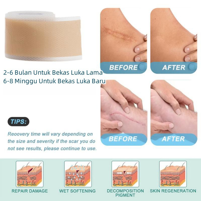 Silicone Scar Sheet 4cm x 1.5m plester Scar Removal Silicone Tape Penghilang bekas luka keloid penghilang strechmark