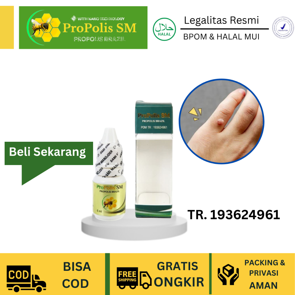 Obat Penghilang Kutil Obat Penghilang Daging jadi Obat Kutil Di Leher Obat Kutil Di Wajah Obat Oles 