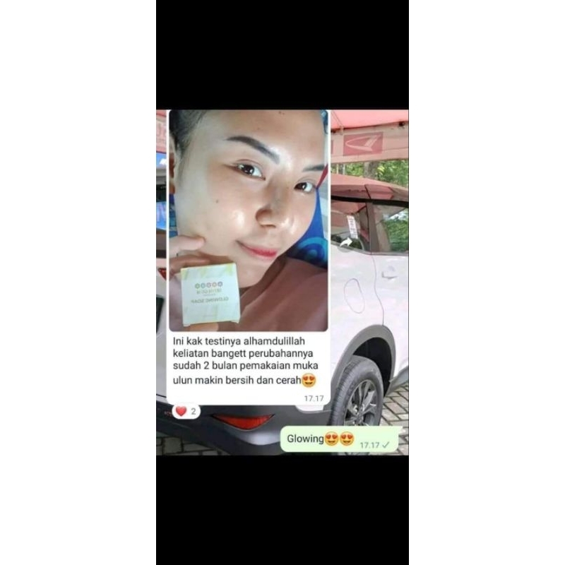 Sabun seom gum Original Sabun Glowing sabun jerawat Feminine soap sabun gatal keputihan