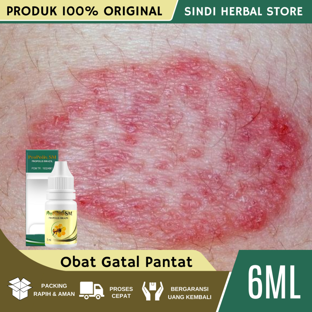 Obat Gatal Pantat, Obat Pantat Hitam Dan Gatal, Obat Gatal Jamur Pantat, Obat Pantat Hitam, Obat Pan