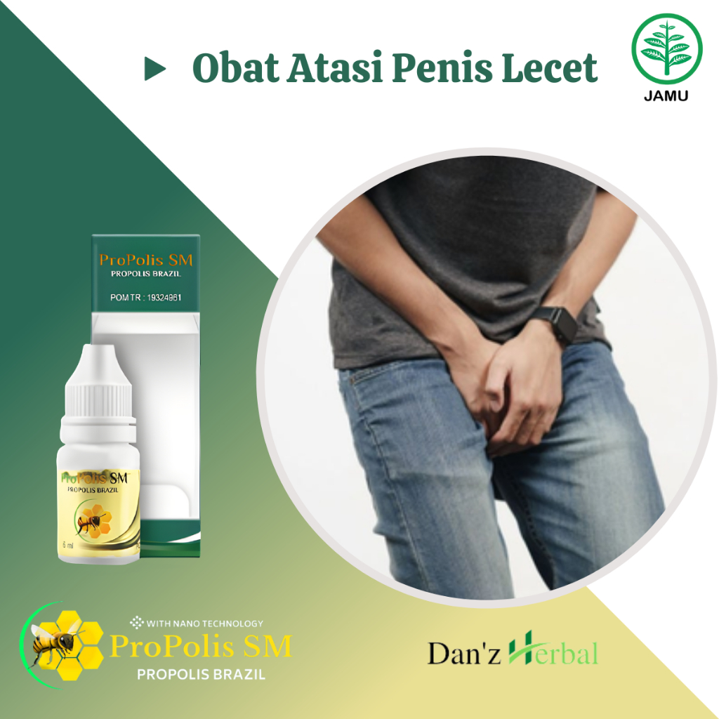 Obat Lecet Kelamin Laki Laki Balanitis Penis Perih Obat Gatal Penis Obat Kepala Penis Lecet Gatal Bu