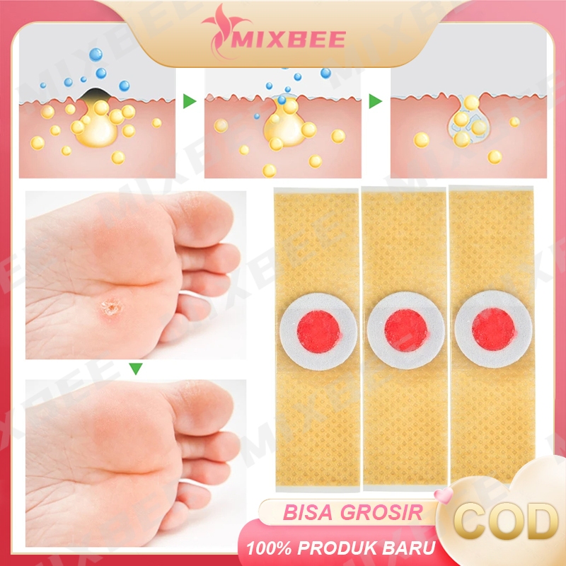 12Pcs Mata Ikan Foot Corn Removal Plester Kutil Penghilang Mata Ikan / Kapalan / Foot Corn Removal