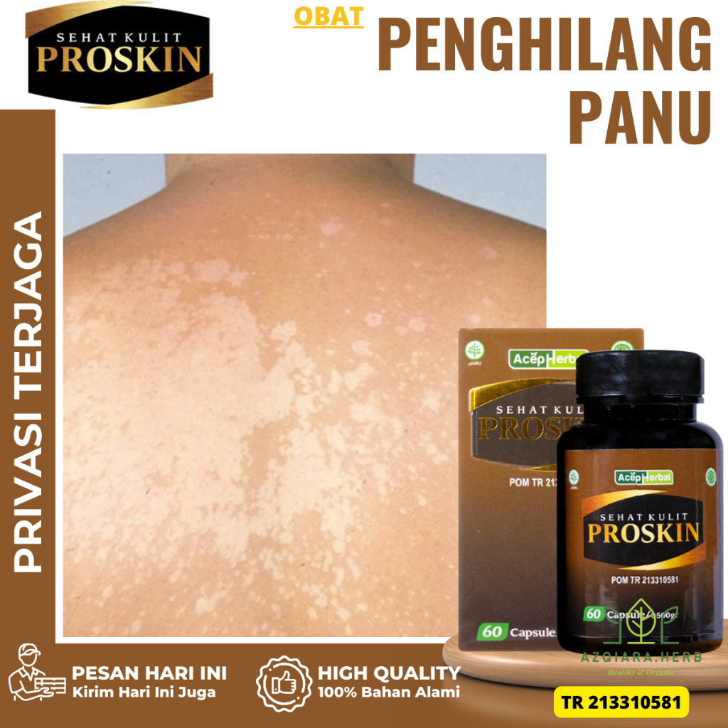 Obat Panu, Obat Kulit Jamuran, Obat Kurap Kudis, Obat Gatal Gatal Kulit, Obat Balas Bogo, Obat Hapur