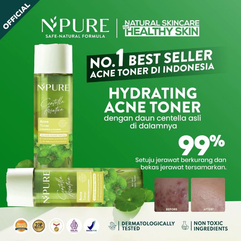 [SALE NED 10/26] N'PURE CENTELLA ASIATICA ACNE TONER, NPURE TONER ACNE FIGHTER