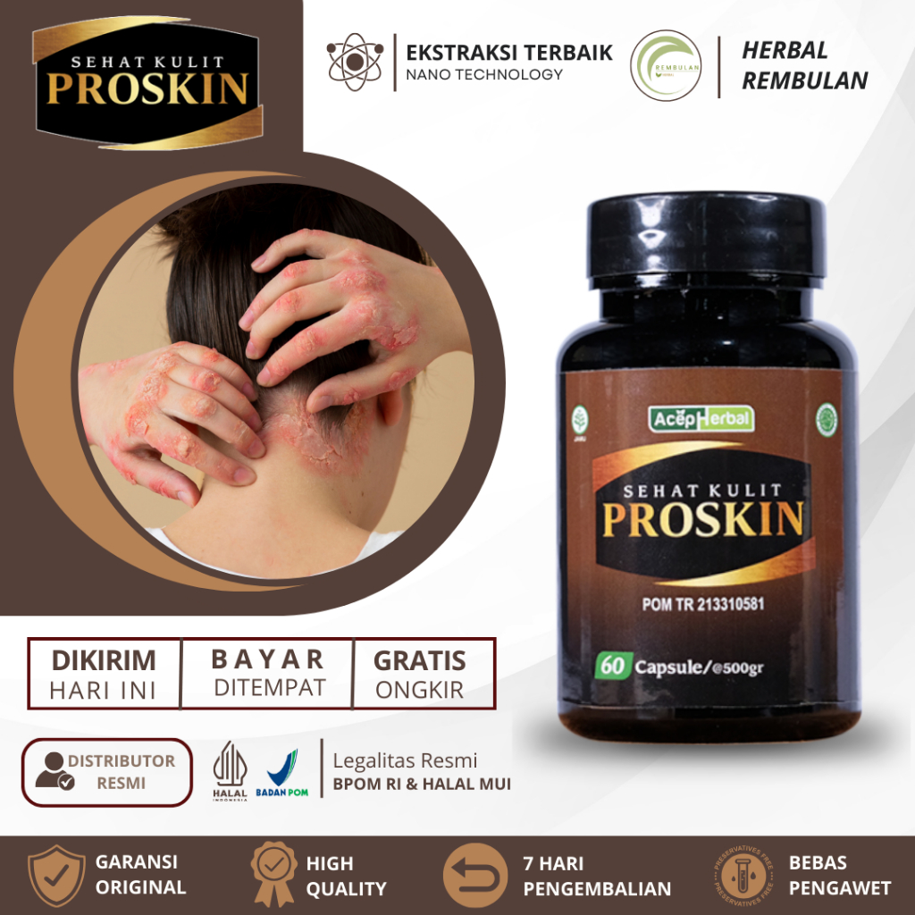 Obat Psoriasis Gatal Jamur, Obat Psoriasis Kepala, Obat Psoriasis Badan, Obat Gatal Jamur Bersisik, 